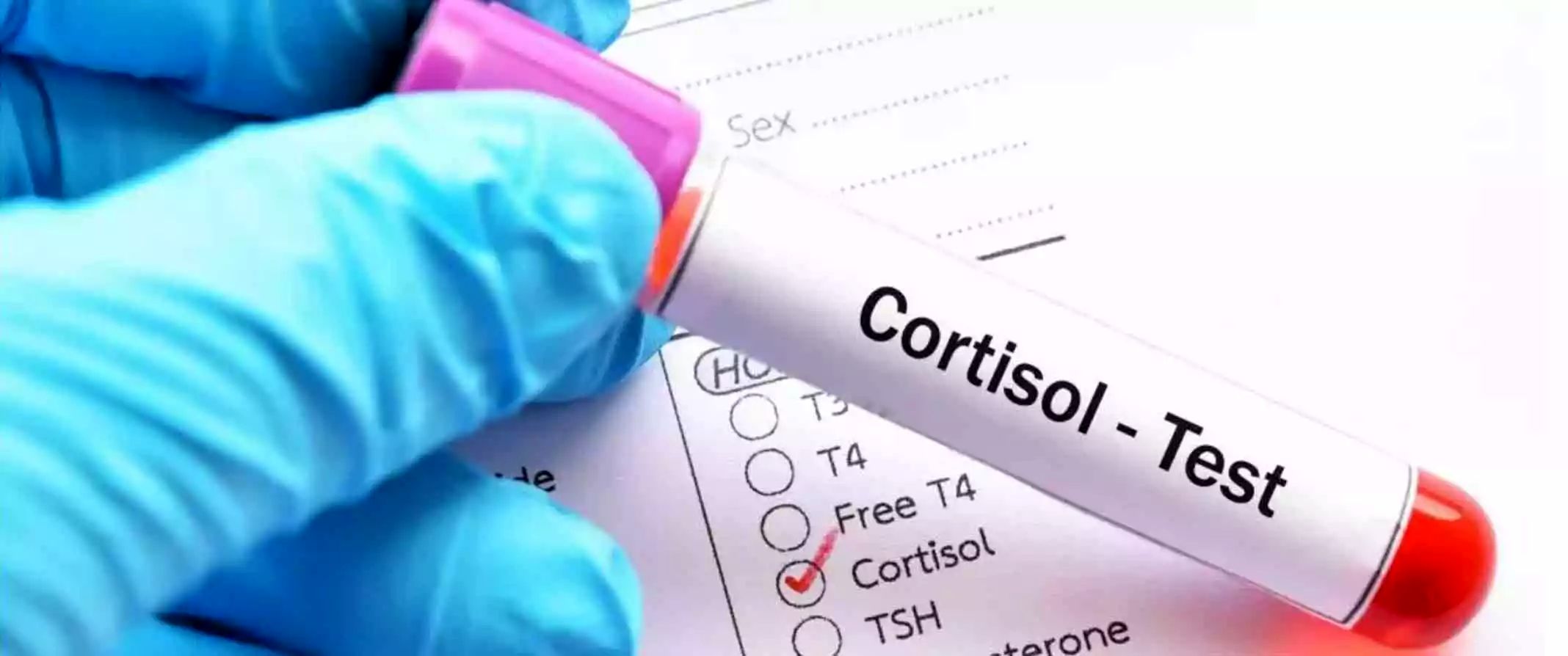 نشانههایی که میگویند سطح کورتیزول بدن بالا رفته است