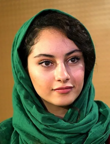 تغییر چهره عجیب ترلان پروانه سوژه شد | ترلان پروانه با ژل لب تغییر قیافه داد