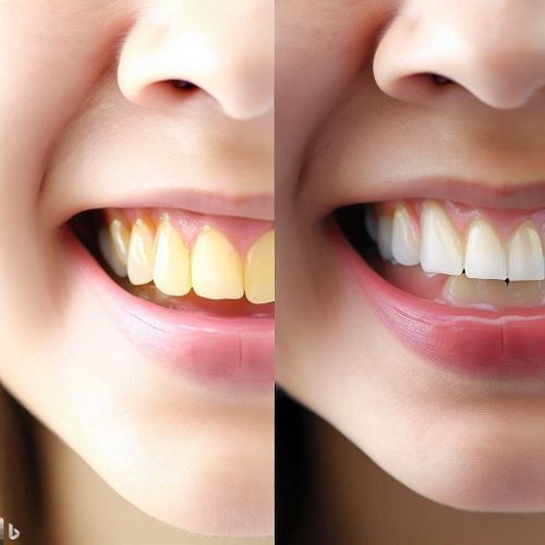 چند روش کاربردی برای سفید کردن دندان در خانه | با این روش ها دندان هاتو برق بنداز