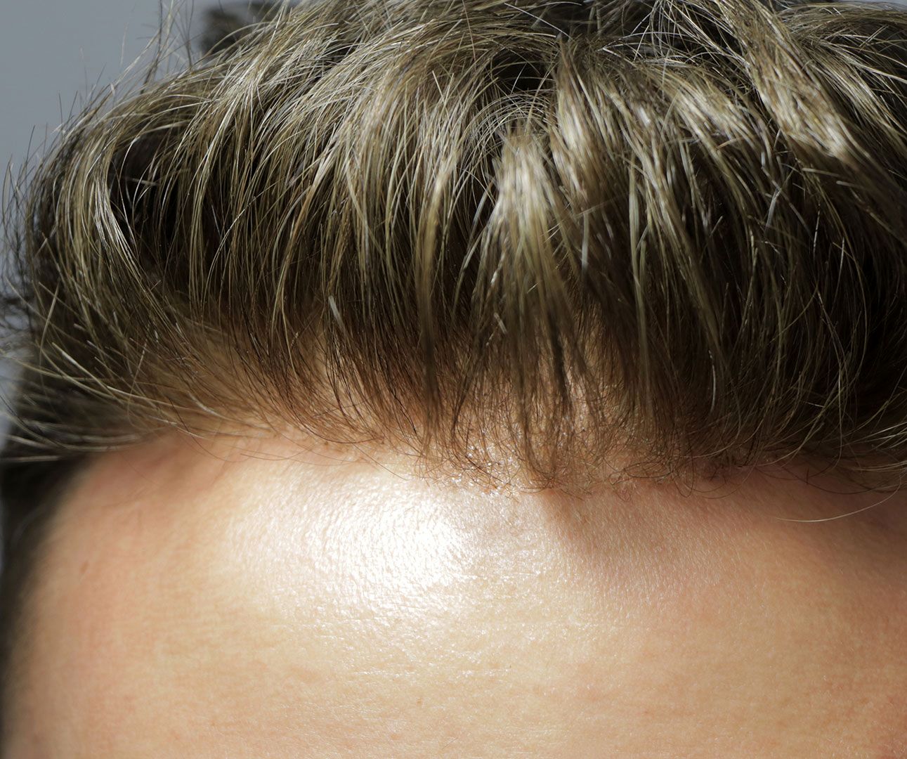 راههای موثر برای رطوبترسانی به موی سر